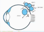 近視眼軸增長引起眼底病變