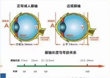 眼軸的發育規律