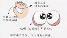 早起眼角的“眼屎”是什么?