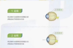 遠視就可以看的更遠嗎?