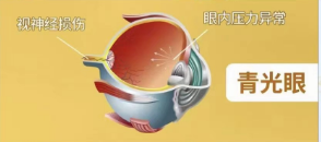 為什么不能關燈玩手機